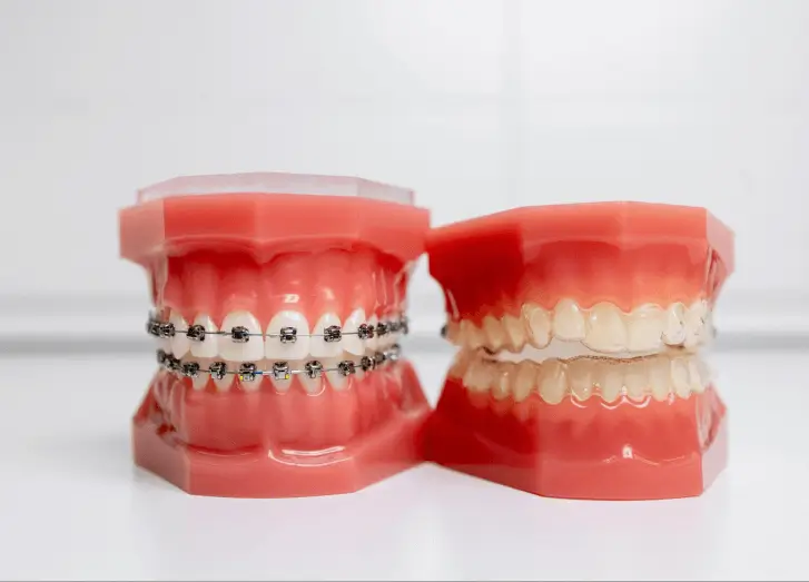 Braces-vs.-Invisalign_-What-Orthodontists-Consider-When-Choosing-Between-The-Two-1