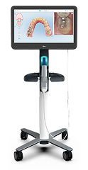 iTero Digital Scanner